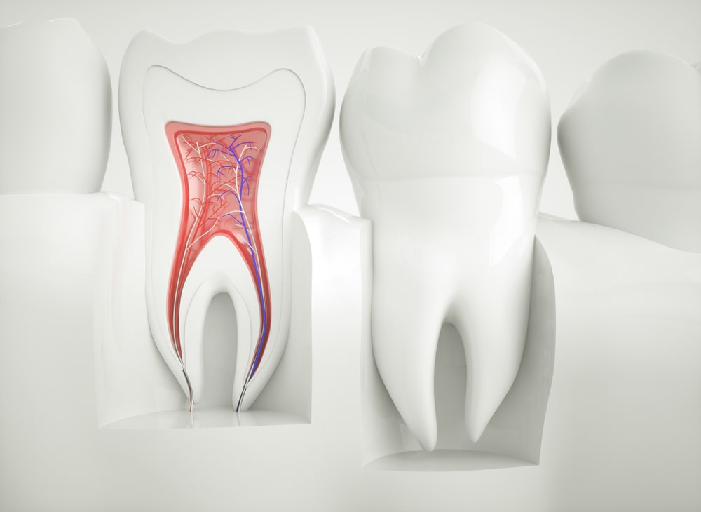 Root canal treatment Campbelltown – When it is needed