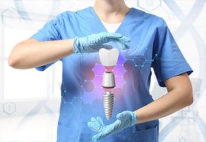 Cheapest-Dental-Implants-In-Australia-image-campbelltown