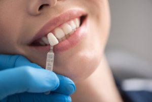 dental-implants-cost-india-crown-colour-campbelltown