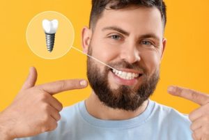 Dental Implant Cost in Kuala Lumpur location