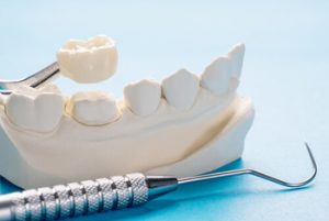 What Are Dentures Made Of impression