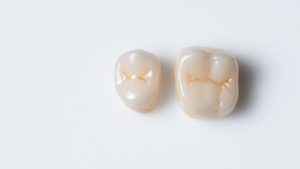 What Does a Crown Look Like on a Tooth shell